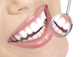 Diş Tartarı Nedir ve Nasıl Tedavi Edilir 3