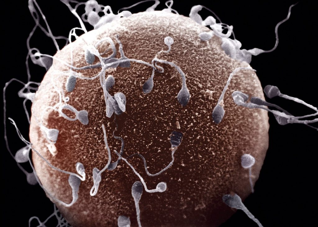Sperm Kalitesi Nasıl Artırılır 1