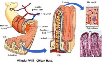 colyak-hastaligi-nedir-ve-belirtileri-nelerdir-4