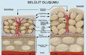 selulit-olusumunu-onlemek-icin-organik-tedaviler-nelerdir-5